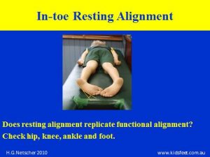 Resting alignment of in-toer